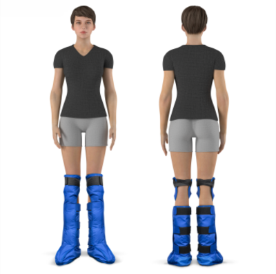 Aukštų terapinių batų naudojimo pavyzdys, rodantis kaip ARTRAID batai apgaubia pėdų ir blauzdų sritį stabilumui ir komfortui.